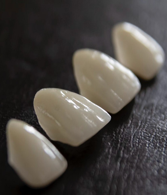 Porcelain Veneers Christchurch Porcelain Veneers Christchurch