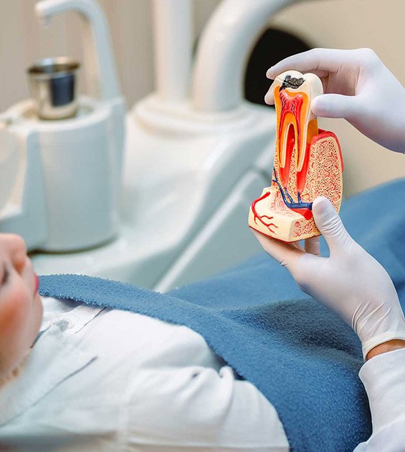 Expert Root Canal Treatments Christchurch