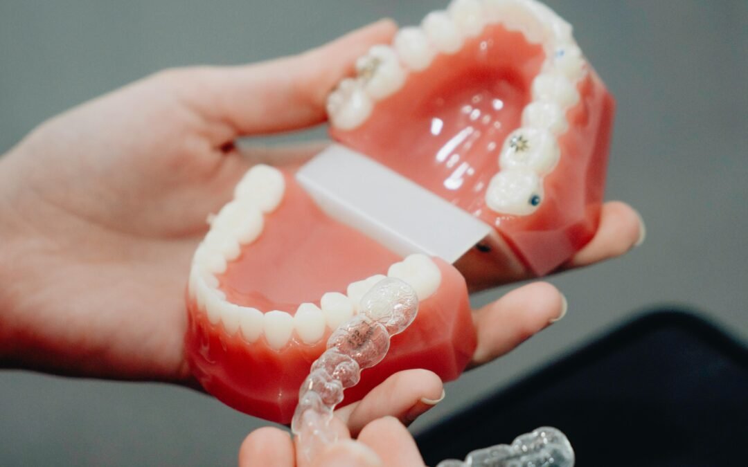 Wisdom Teeth Removal: Signs It’s Time To Get It Done