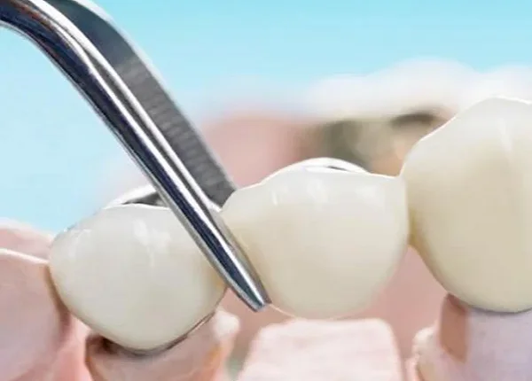 Dentist Belfast