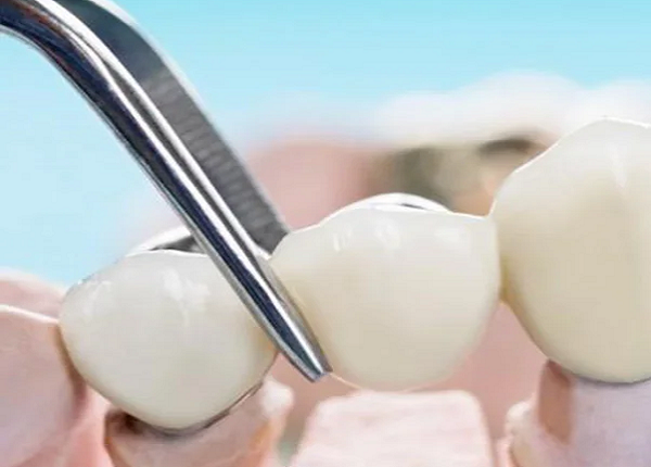 Dentist Fendalton