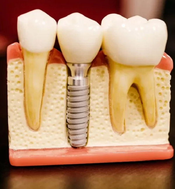 Expert Dentists Casebrook