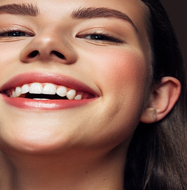 Professional Teeth Whitening Professional Teeth Whitening