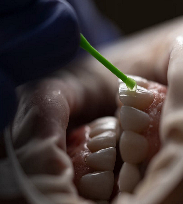 Teeth Whitening Christchurc Teeth Whitening Christchurc