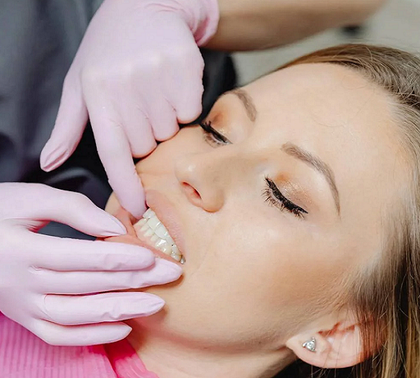 Crowns and Bridges Treatment