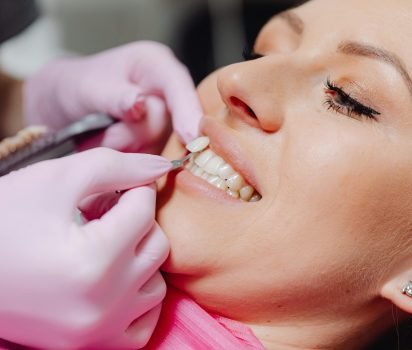 Veneers